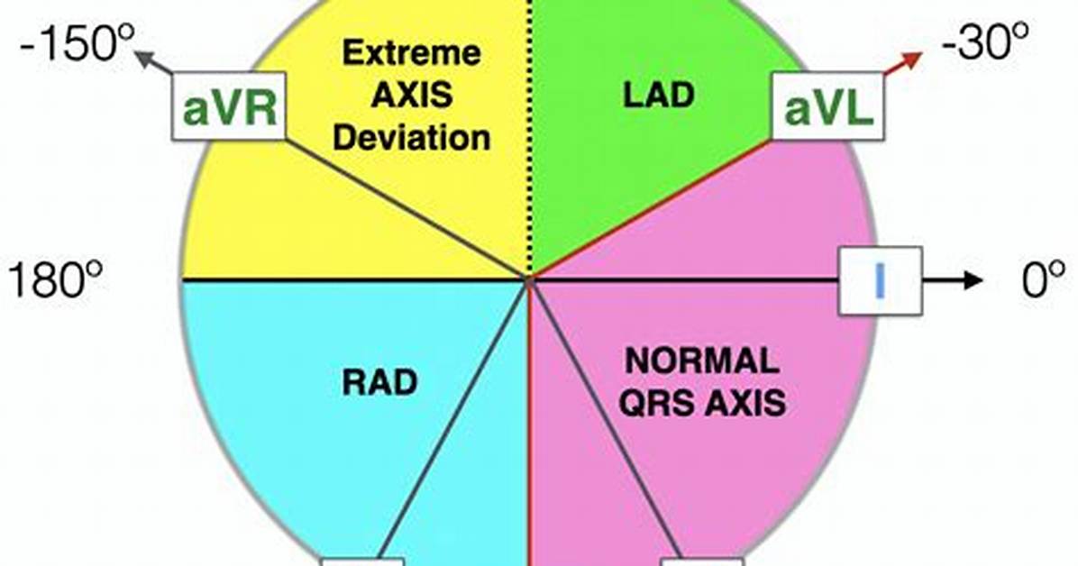 Axis Ecg
