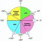 Axis Ecg