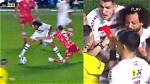 Badly Injure