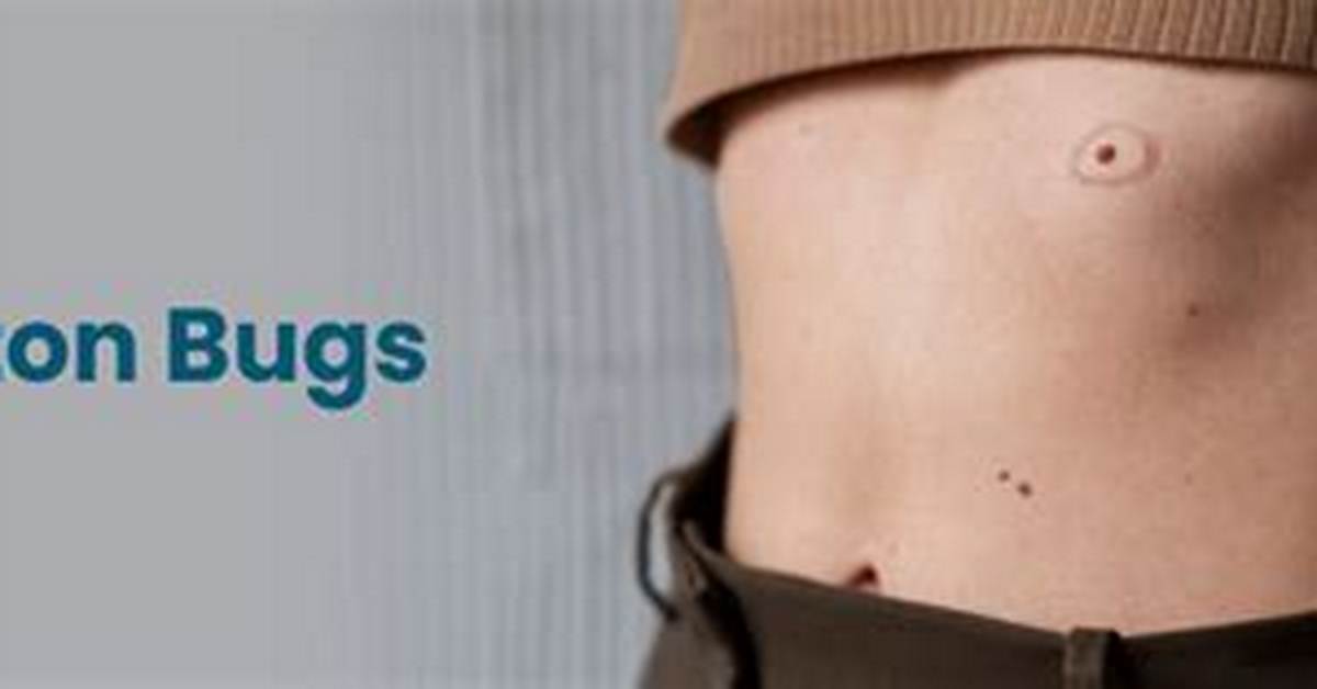 Belly Button Bugs