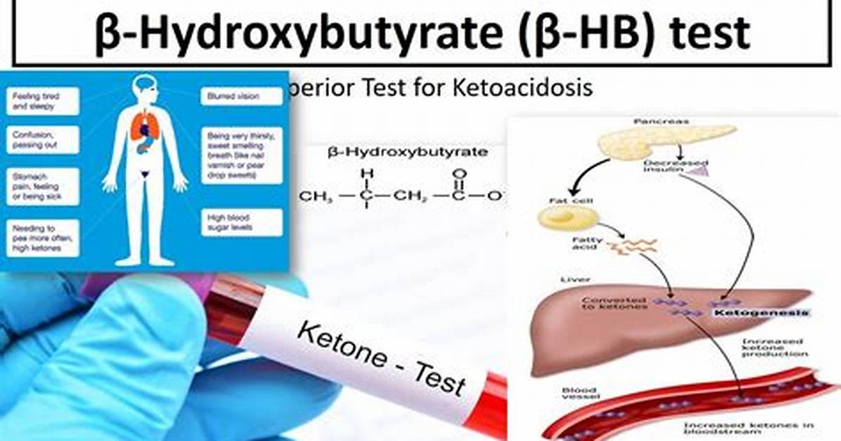 Beta Hydroxybutyrate Test