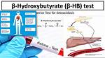 Beta Hydroxybutyrate Test