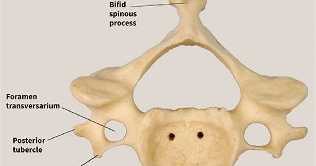 Bifid Spinous Process