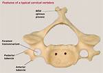 Bifid Spinous Process
