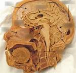 Bisected