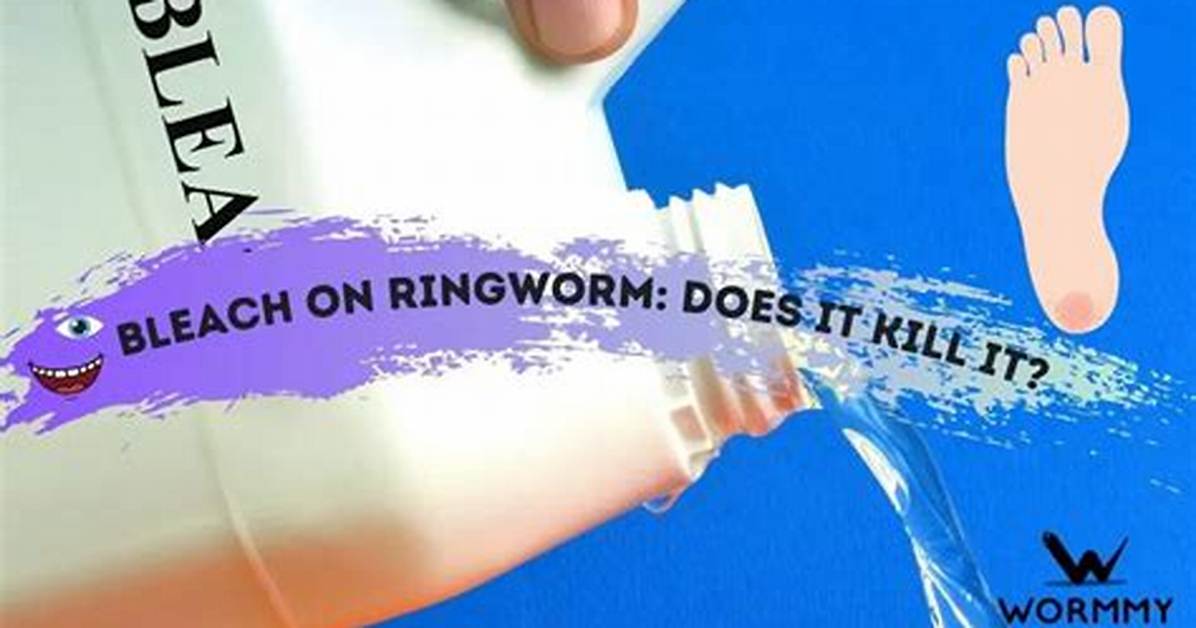 Bleach on Ringworm