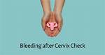 Bleeding Cervix When Touched