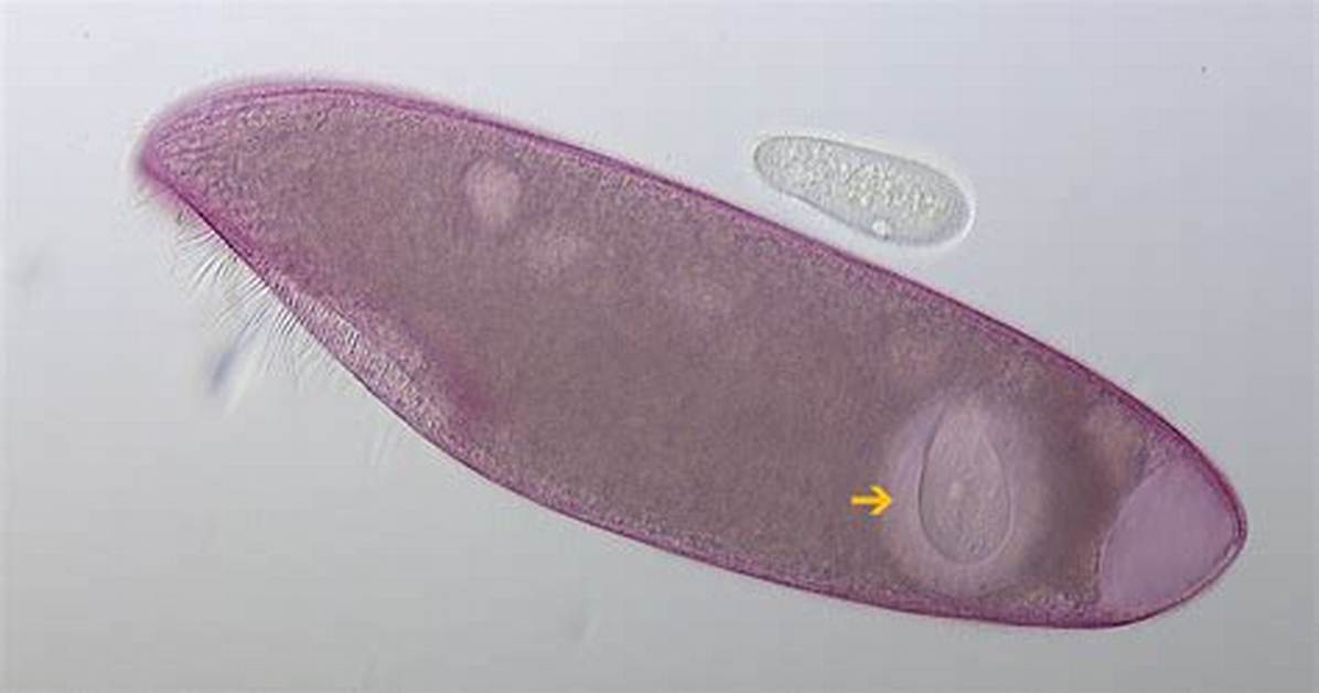 Blepharisma