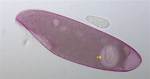 Blepharisma