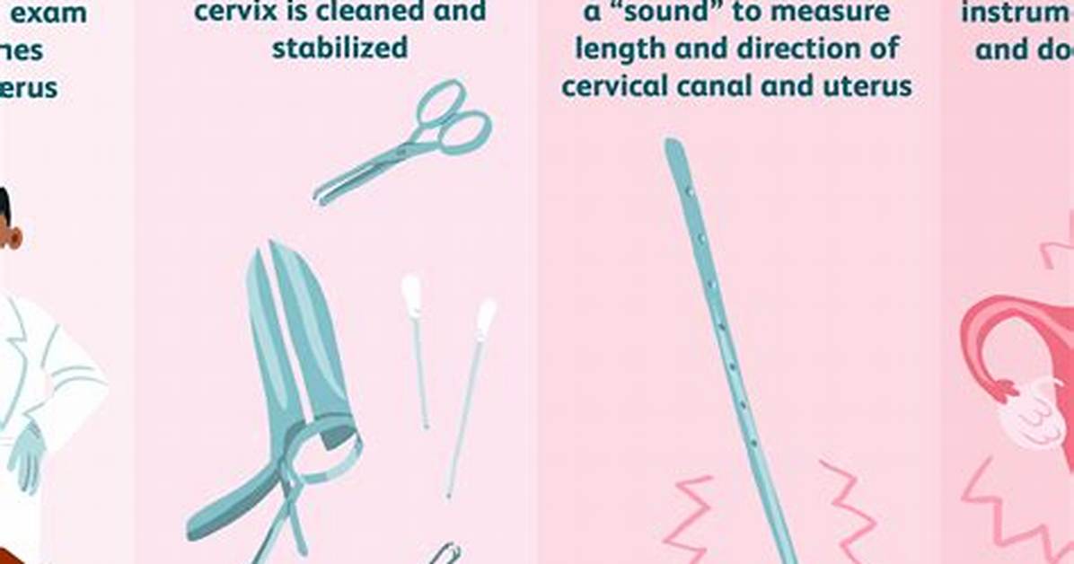 Bloating After Iud Insertion - Statcare
