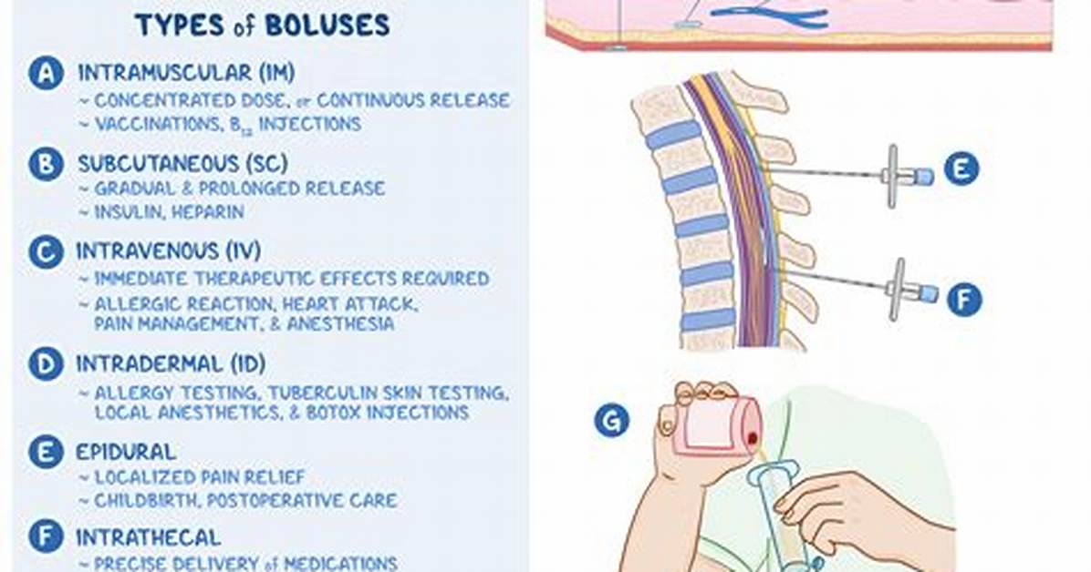 Bolus Injection