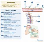 Bolus Injection