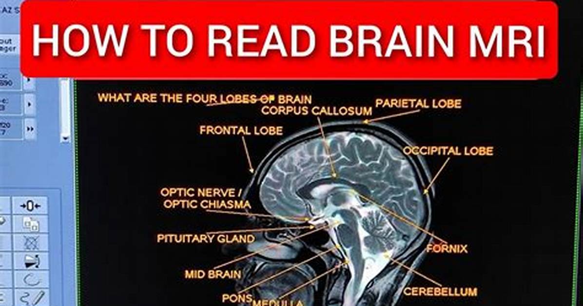 Brain Scan: Abbr.