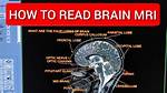 Brain Scan: Abbr.