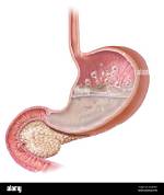 Bubbles in Stomach