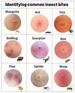 Bug Bite with White Head