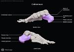 Calcaneus Tuberosity
