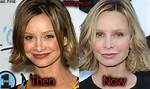 Calista Flockhart Plastic Surgery: Secrets Behind 59-Year-Old Calista's Seemless Beauty!