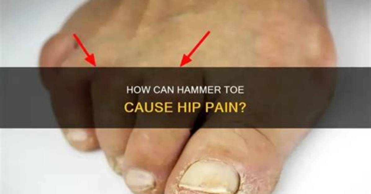 Can a Toe Cause a Pull