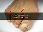 Can a Toe Cause a Pull