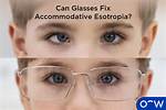 Can Accommodative Esotropia Be Fixed?