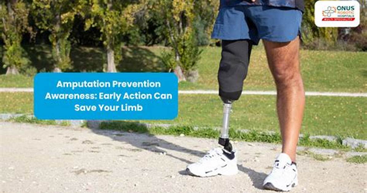 Can Amputation Be Avoided?