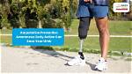 Can Amputation Be Avoided?