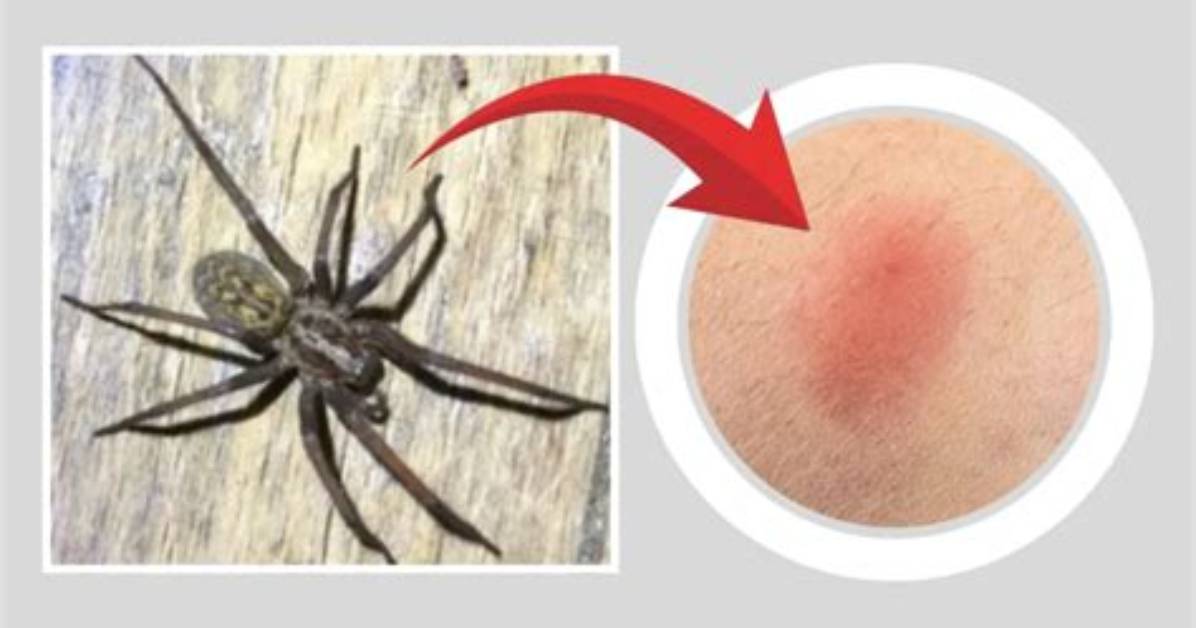 Can Big Spiders Bite