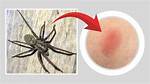 Can Big Spiders Bite
