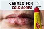 Can Carmex Help Cold Sores?