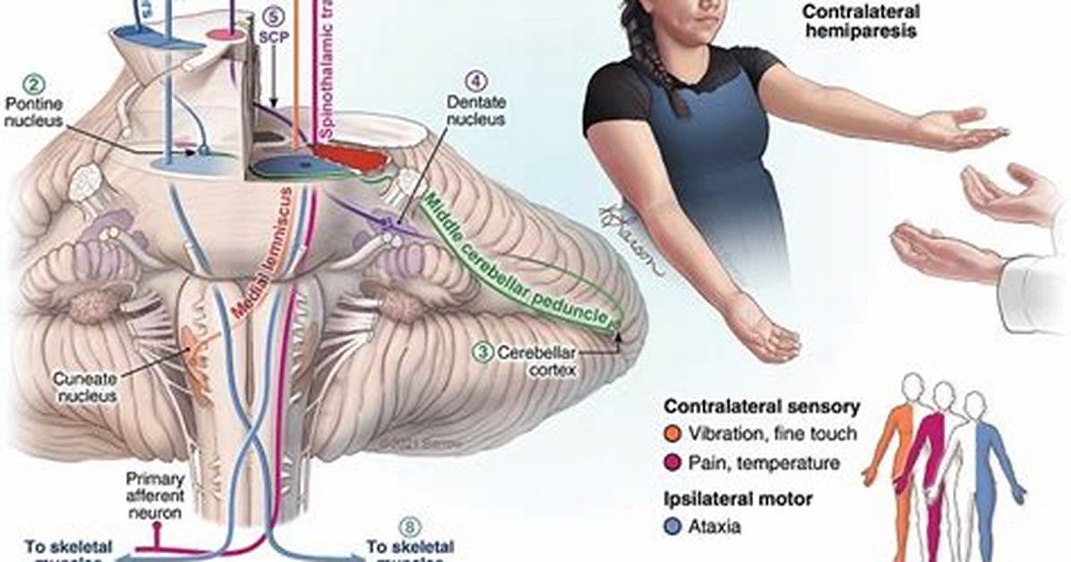 Can Cavernomas Cause Headaches?