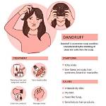 Can Dandruff Cause Itching?