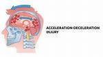 Can Deceleration Kill You?