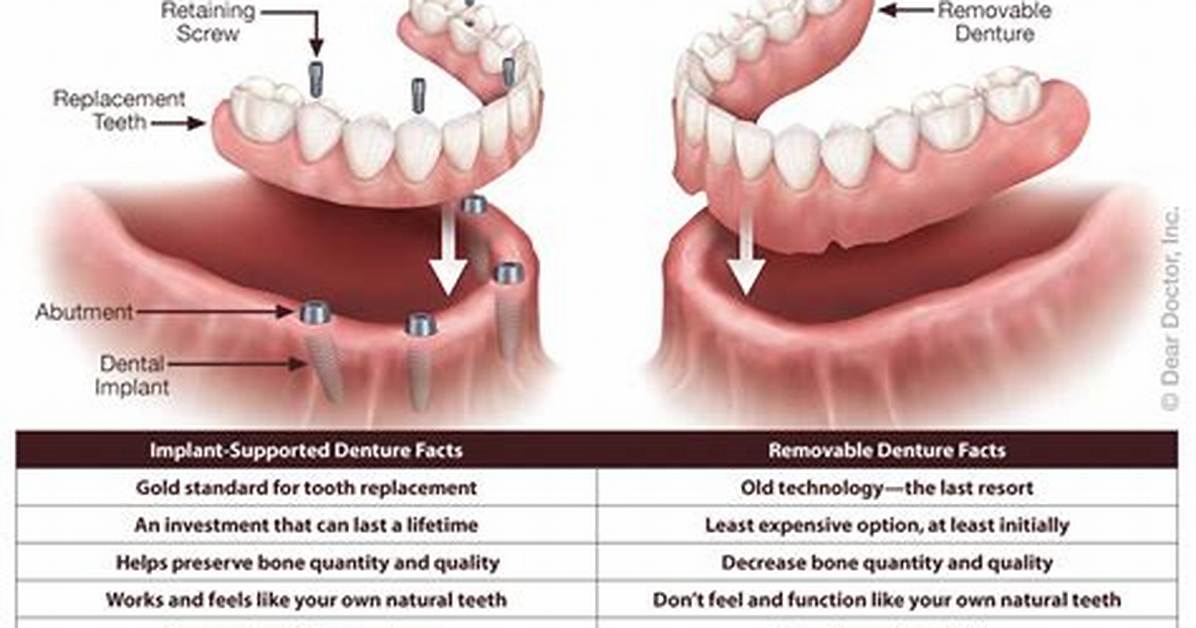 Can Dentures Be Fixed?