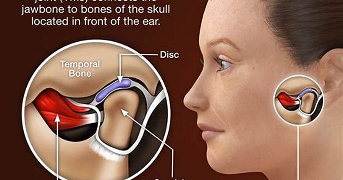 Can Ear Problems Cause Tmj?