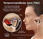 Can Ear Problems Cause Tmj?