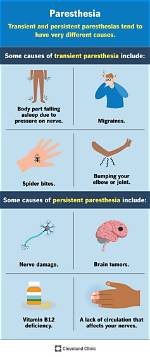 Can Exercise Cause Paraesthesia?
