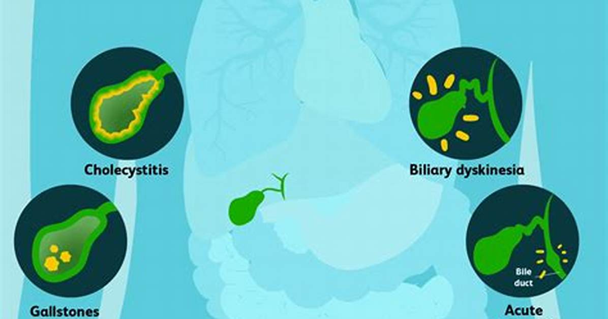 Can Gallbladder Cause Wind?