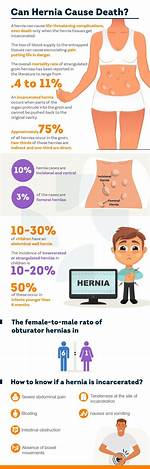 Can Hernia Kill You?