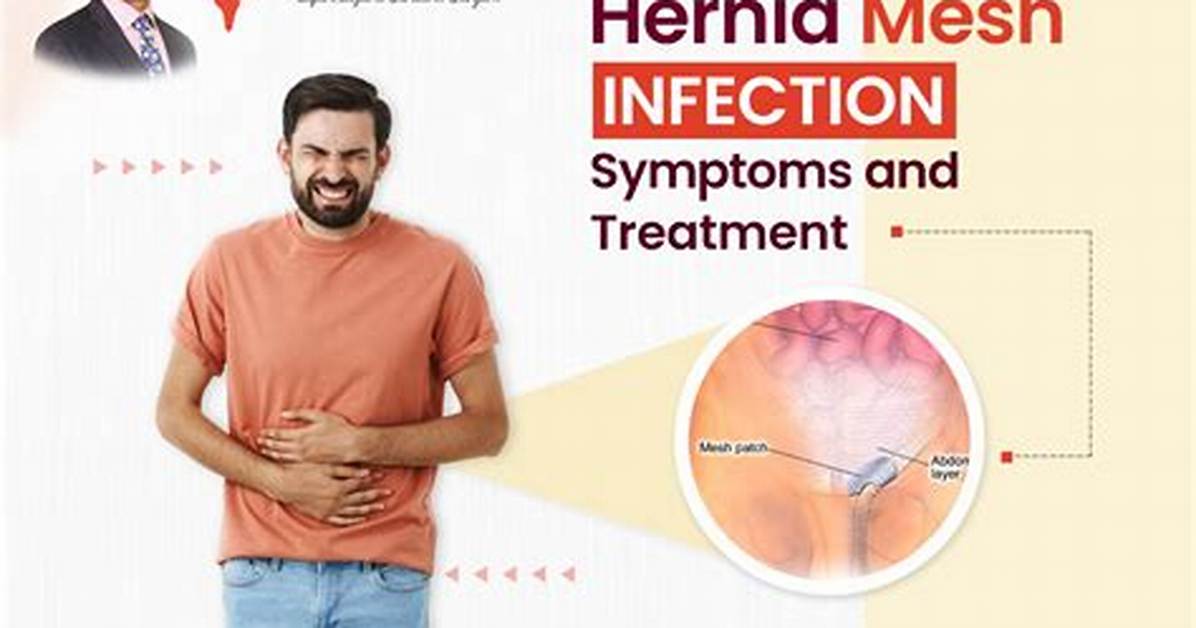 Can Hernia Mesh Cause Bladder Problems?