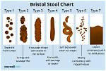 Can Narrow Stools Be Normal?