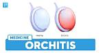 Can Orchitis Come Back?