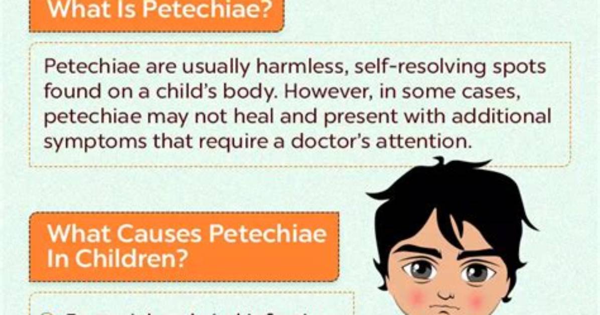 Can Petechiae Be Harmless?