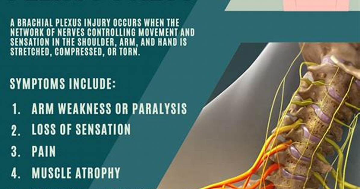 Can Plexus Cause Headaches?