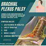 Can Plexus Cause Headaches?
