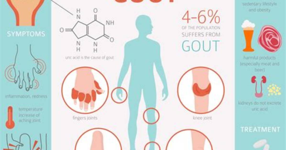 Can Shellfish Cause Gout?