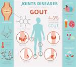 Can Shellfish Cause Gout?