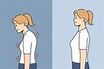 Can Stooped Posture Be Corrected?