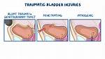 Can the Bladder Be Repaired