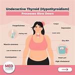 Can Thyroid Problems Cause Obesity?